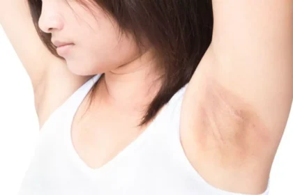 Ketiak Perih Setelah Pakai Deodoran?