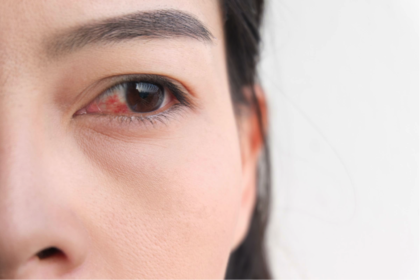 Kenapa Mata Pedih Saat Memakai Makeup?