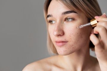 Bolehkah Jerawat Pakai Retinol?