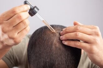 Minoksidil: Antara Manfaat dan Risiko untuk Kesehatan Rambut
