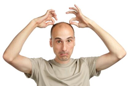 Bolehkah Pakai Minoxidil ke Rambut?