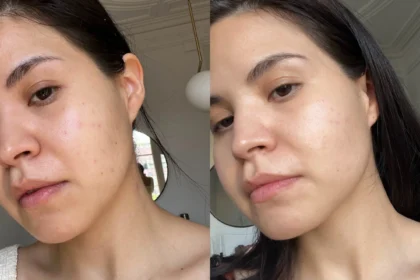 Niacinamide: Si Ajaib Pencerah Kulit